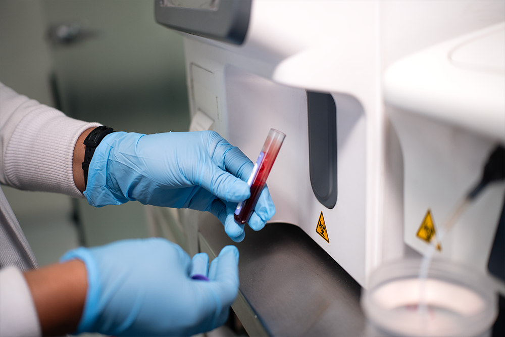 Servicio de laboratorio clínico en Quito