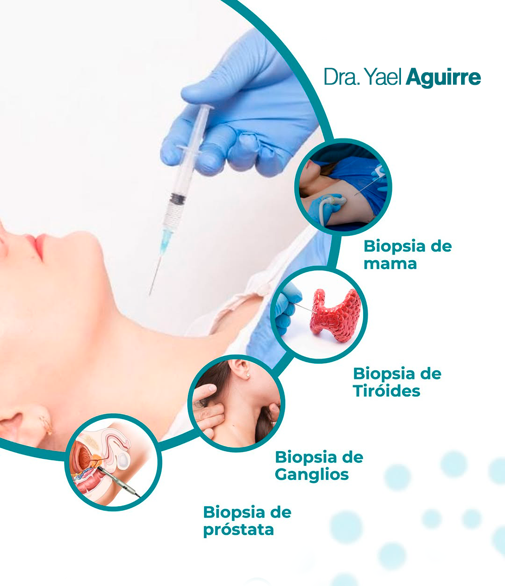 Dra. Yael Aguirre: imagenología y radiología especializada